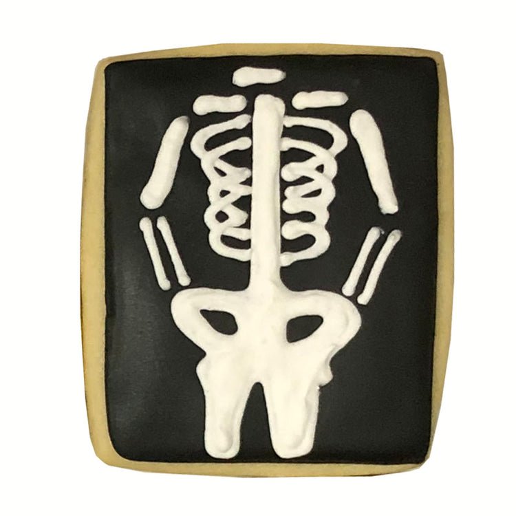 Get Well Soon Gift Box cookie with white skeleton X-ray design